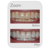 Before And Afters Zoom (2)