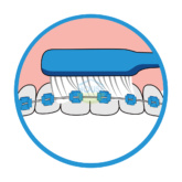 Bridgeimplant Floss Illustration Thehouseofmouth 04