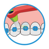 Bridgeimplant Floss Illustration Thehouseofmouth 04