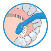 Bridgeimplant Floss Illustration Thehouseofmouth 04