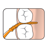 Tepeeasypicksizex Smallsmallorange36pkuse3 Thehouseofmouth