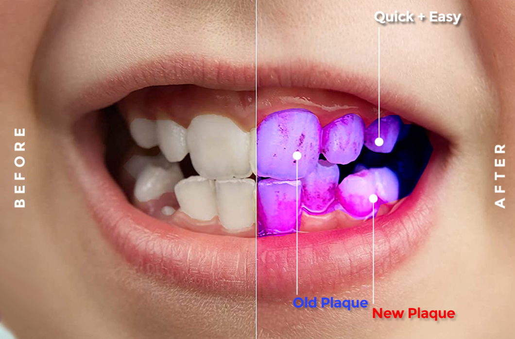 Disclosingbeforeaftertwoexp Thehouseofmouth