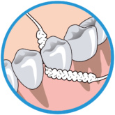 Oralbsuperflossinstruction2 Thehouseofmouth 01