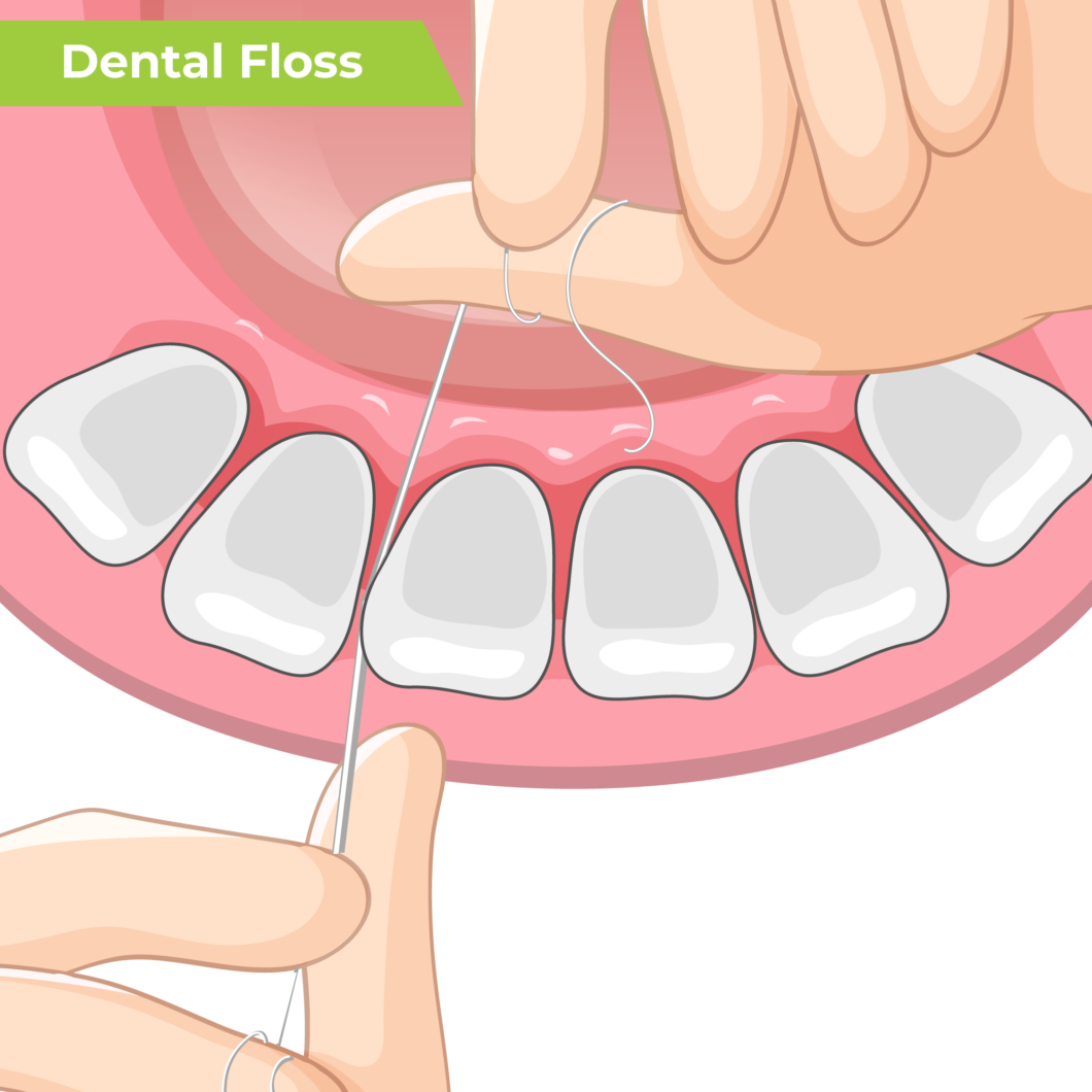Advantages Of Flossing