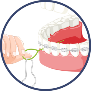 Carefully Begin Flossing Gaps