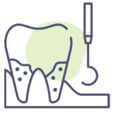 Removal Of Plaque And Food Particles