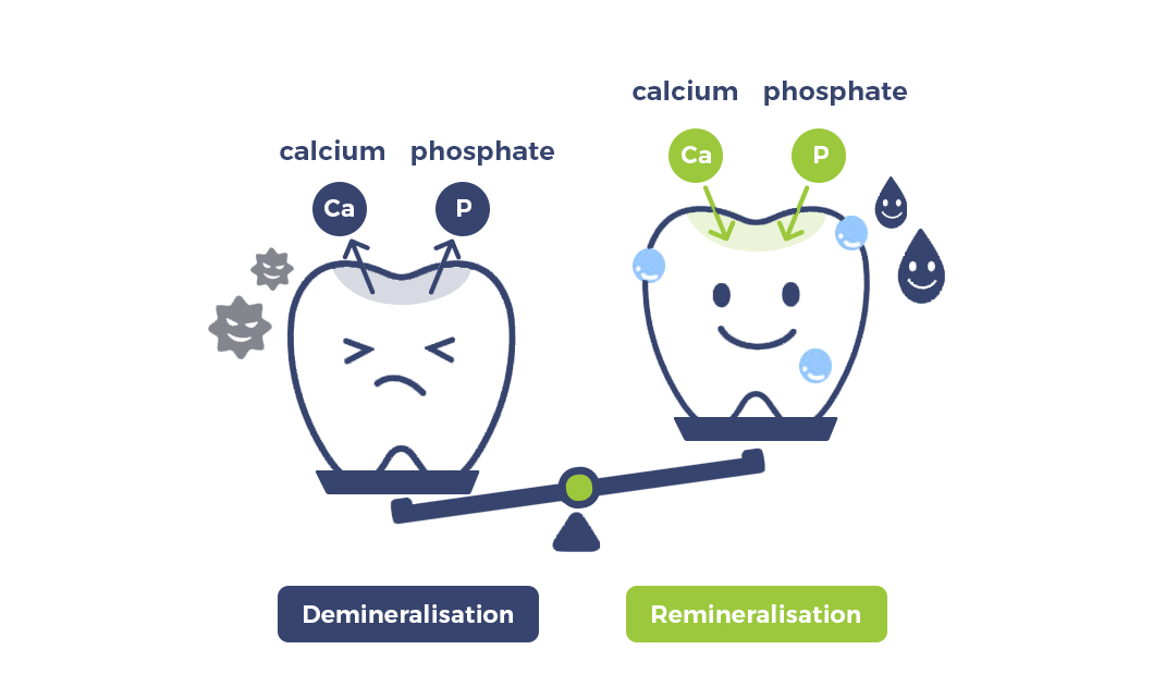 What Is Demineralisation