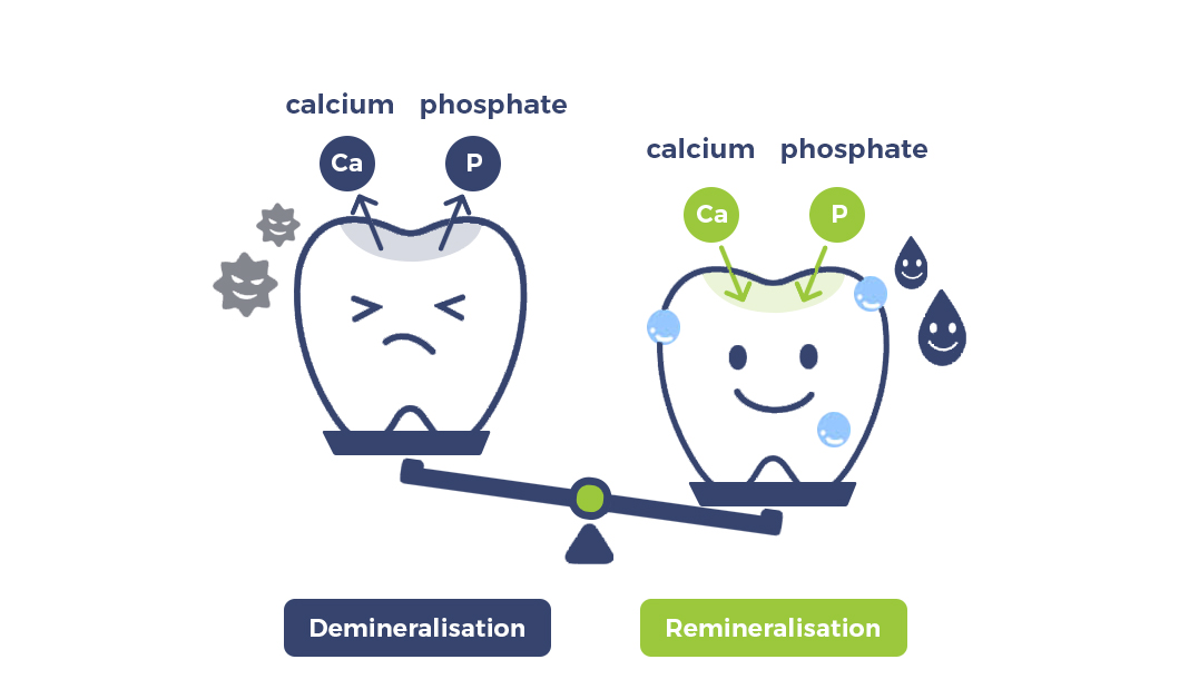 What Is Remineralisation