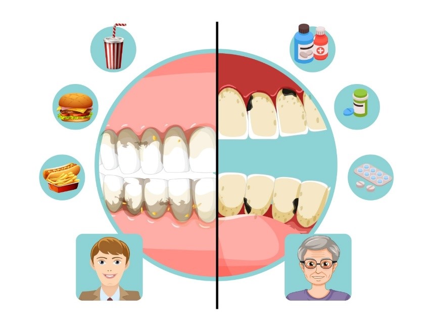 Understanding Tooth Discolouration