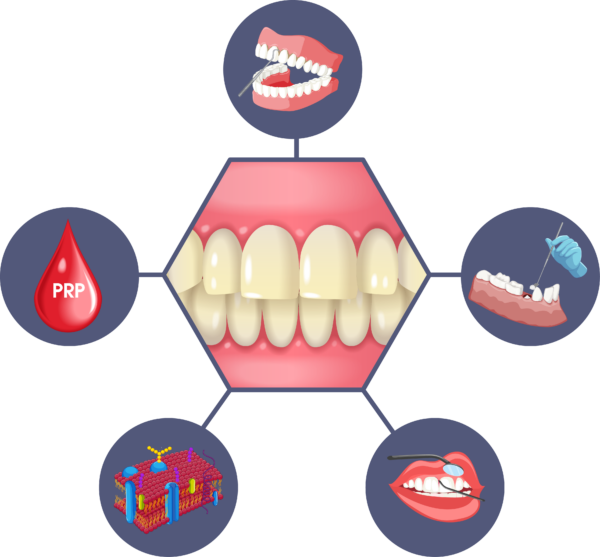 Surgical Periodontitis Treatments