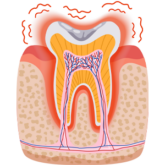 Tooth Pain Or Sensitivity