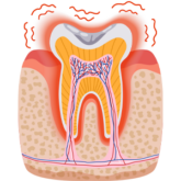 Tooth Pain Or Sensitivity