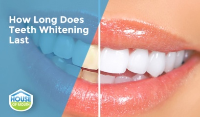 The House Of Mouth Looks At How Long Does Teeth Whitening Last