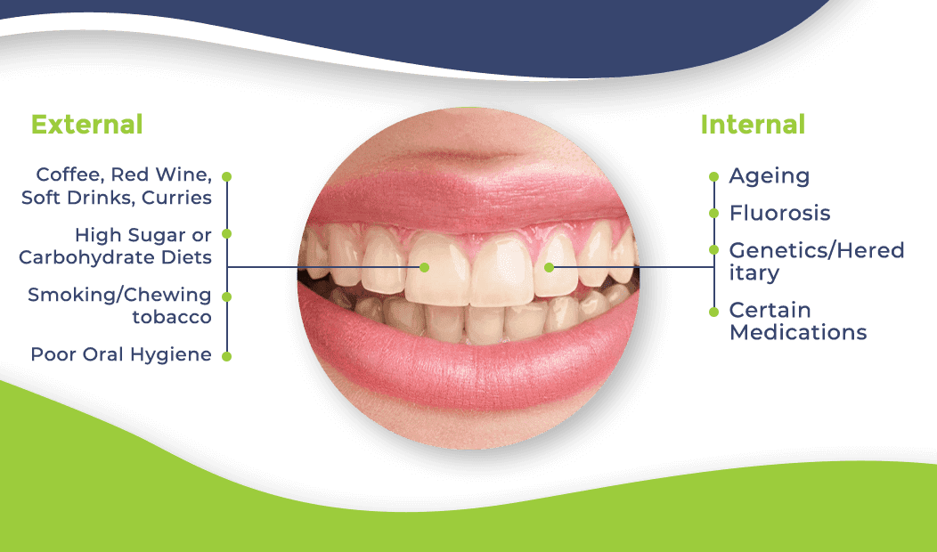 How To Make Your Teeth Less Yellow Once And For All