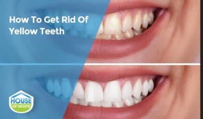 Before And After Of A Woman Showing How To Get Rid Of Yellow Teeth