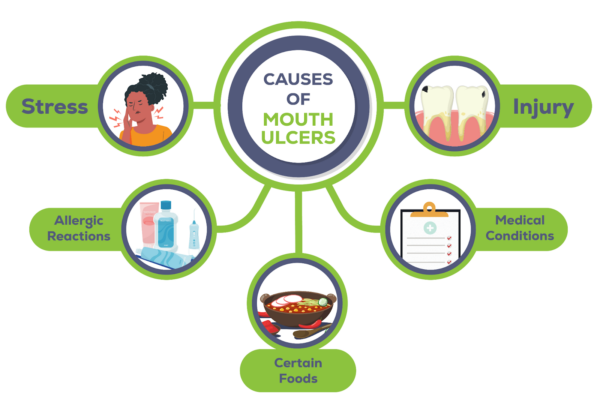 Infographic On Causes Of Mouth Ulcers