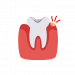 Inflamed Or Swollen Gums