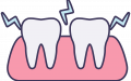 Sensitive Teeth 23