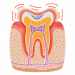 Sensitive Teeth