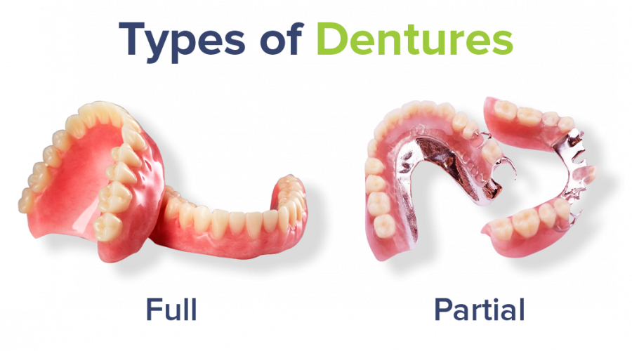 Types Of Dentures