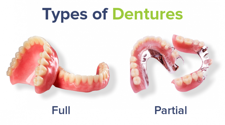 Types Of Dentures